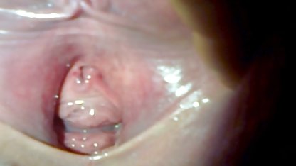 Penggemar polandia video bokep jilbab toge